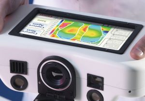 thermal camera diabetic heat mapping